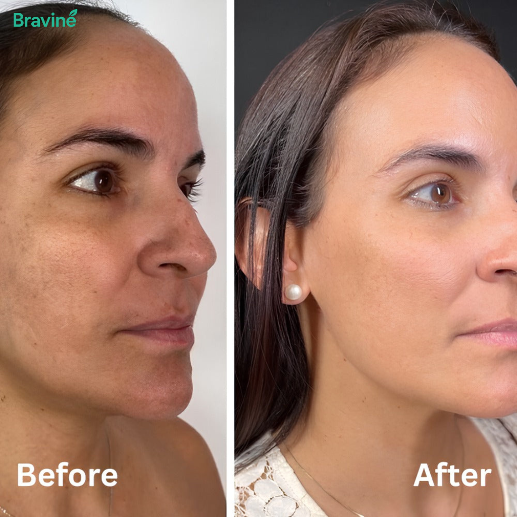 Bravine Beauty Peel Shot - White + Black Rice Set